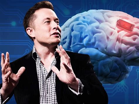 rfid chip brain implant|Elon Musk's Neuralink has put in its first human brain implant.